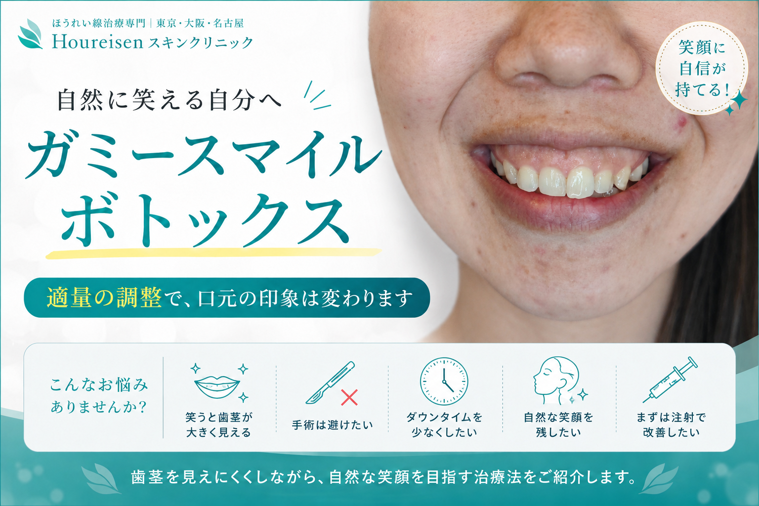 笑った時の歯茎の露出を改善！ガミースマイルをボトックス注射で簡単に