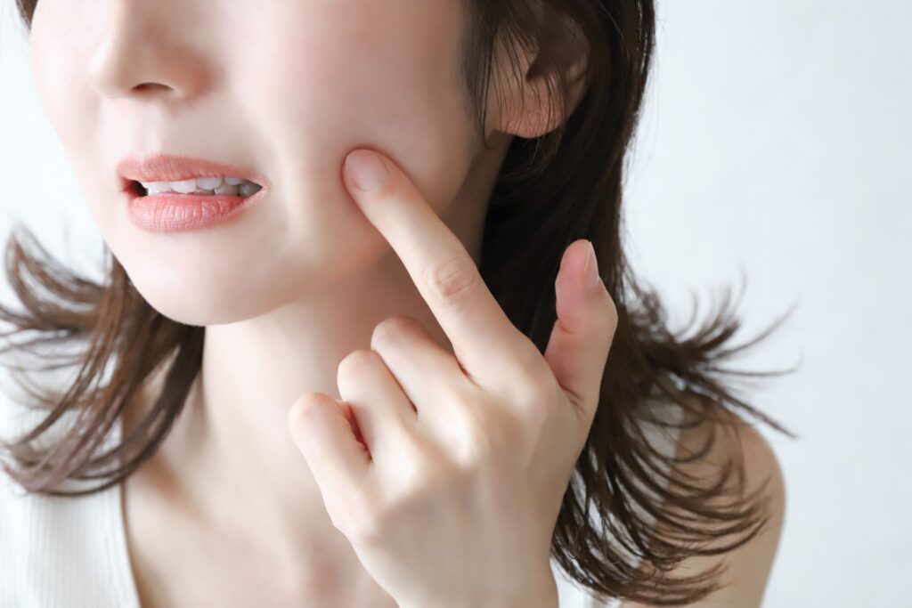 頬のたるみ