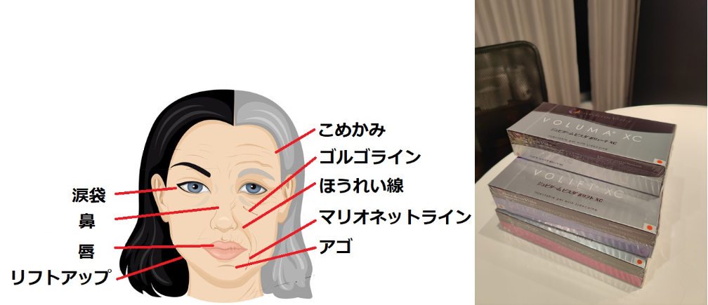 ジュビダームビスタシリーズの種類