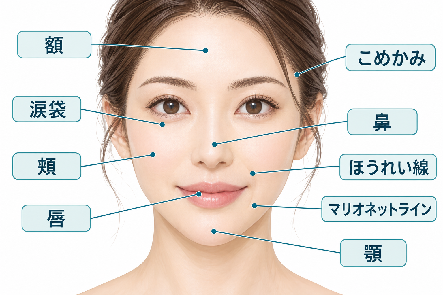Common facial areas treated with hyaluronic acid filler